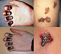 Thumbnail for version as of 22:48, 11 December 2010