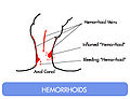 Thumbnail for version as of 15:05, 5 March 2011