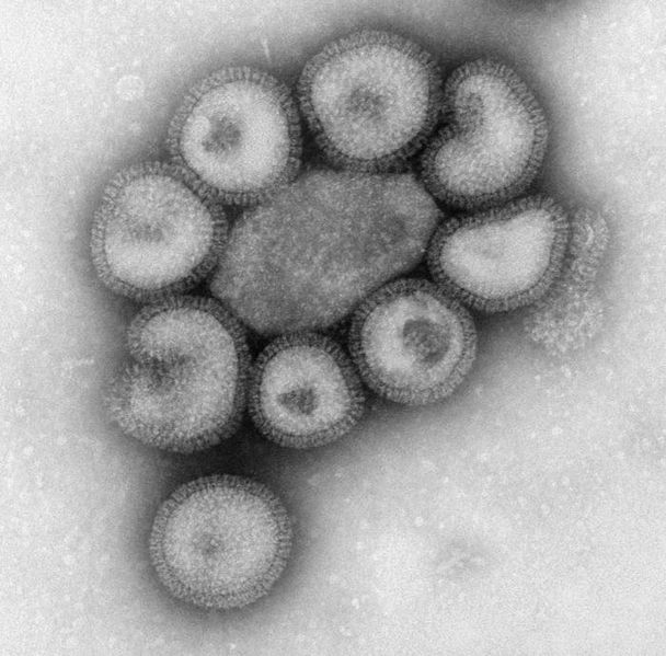 File:Influenza-Virus.jpg