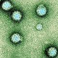 Thumbnail for version as of 13:09, 12 June 2010
