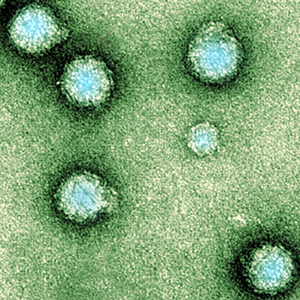 File:Chikungunya-Virus.jpg