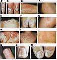 Thumbnail for version as of 16:35, 25 October 2011