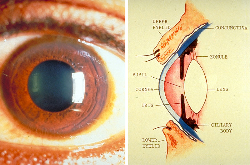 File:Eye-3.jpg